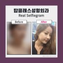 더탑성형외과의원 이미지