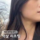 지장사지 | 평촌역 다이어트한의원 이중턱살 리프팅 &amp; 약침 관리 후기