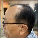 이화보청기 이미지