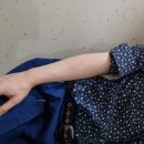 전주미용실 기도하는오원장 평화동 태성 한의원에서 손목 통증 치료 후기