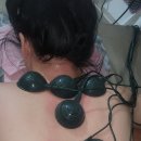 지지지샵 | 필수 코스, 차이나풋샵 통증 없는 지샵 마이크로젯레이져로 기미 주근깨 고민 해결하고 온 솔직 후기