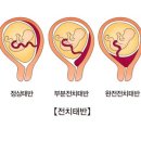 전치 앞(1) 이미지