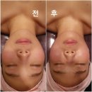 서윤피부맑음 명동점