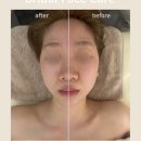 얼라인 짐 | Face Care by ALIGN 그날을 위한, 나만을 위한 관리, 얼라인에스테틱의 신부관리로 제대로 효과보세요 :)