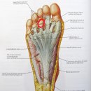 발바닥에 섬유종 생기신분들 이미지