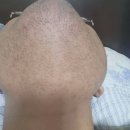 죽전바른신경과의원 이미지