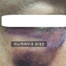 리뉴미피부과 이미지