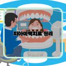 미백 이미지