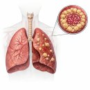 대한결핵협회부설복십자의원 | 신림 서울복십자의원 잠복결핵 검사 ②ㅣ 결과 후기...온라인 발급 방법, 발급순서, 대한결핵협회 사이트