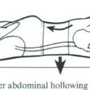 Quantification of Lumbar Stability by Using 2 Different Abdominal Activation Strategies : 강추논문 이미지