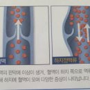 현대항분하지외과의원 네이버블로그