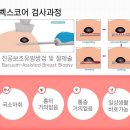유방 혹 제거 (맘모톰/벡스코어) 수술하고 왔어요~ (노원미유여성외과, 당일 입원, 통증, 비용)
