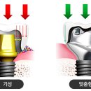 예치과기공소 이미지