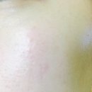 (주)비에프메디컬 이미지