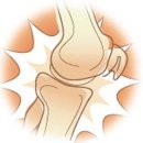 [관절염예방방법-스포츠손상]무릎관절 구조 관절염은 왜 생기는 것일까 - 사당연세사랑병원 이미지