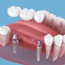 더블유(W)서울치과의원 이미지