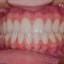 최상윤치과의원 네이버블로그