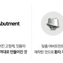 참조은치과기공소 이미지