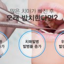 틀 치과의원 이미지