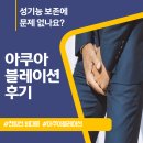 아쿠아블레이션 후기, 후회없는 전립선비대증수술 고르는 기준