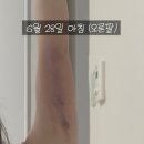 리라헬스케어 | 범계역 다이어트｜리라쉐잎+운동 병행 솔직후기(비포애프터 사진 포함)
