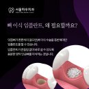 서울하우치과 이미지