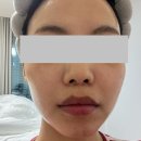 물방울 초음파 LDM 뷰티 디바이스 구매 : 톰 더 글로우(THOME THE GLOW), 내돈내산 후기
