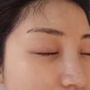 리온에너지 | 성신여대피부관리 리온에스테틱 후기｜저온 플라즈마 리온아크네로 속건조·여드름 진정!