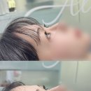 지니래쉬 네이버블로그