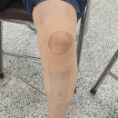 테이핑 및 마사지 이미지