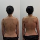 명진한의원 | [피부•바디관리샵] 수백 써도 안 됐던 라운드숄더, AI 바디스캐너로 달라진 1회차 결과 ‘스페이스뷰티...