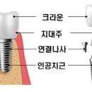 서울봄플란트치과의원 이미지