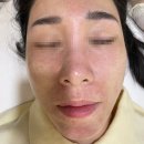 세븐일레븐 역삼디오빌점 | 강남 피부관리 | 여드름 케어 플라즈마 후기 &lt;이안뷰티&gt;