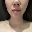 학익동피부관리 인천남구 피부관리샵에서 피부 고민 해결한 후기 ”미엘에스테틱“
