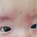 아이앤비팜 이미지