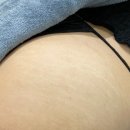 스킨52부천지부 이미지