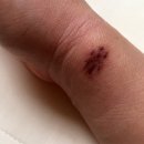 사천제일의원 이미지