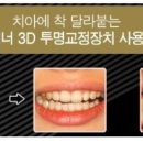 목동중앙치과병원 이미지