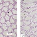 Florfenicol (FF) 10 mg/kg BW 3일 연속 하루 1회 경구투여 후의 새우 간췌장의 조직학적 변화 이미지