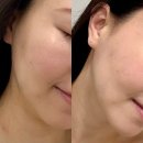 광주역 | [경기광주 윤곽관리] 재방문 윤곽맛집 에스테티아 경기광주역점 관리후기