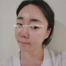 인천 부평 윤곽 림프 피부관리 브이메디스파 본점 에스테틱 후기