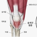 자전거 아래 무릎 통증 (거위발건염) 정형외과 물리치료 및 실비 청구 후기