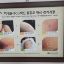 강소아과의원 네이버블로그