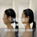 서면 피부관리 1:1관리부터 데콜테까지 꼼꼼한 콤마 후기