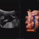 청아여성의원 이미지