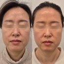 청주 슈퍼젝션 전문점. 수드림 피부관리실 유명한 이유가 있었네