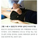 (치료)Quadriceps ms patella fuctional massage/stretching 이미지