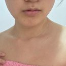 비손 비격 | 강남피부관리 ND헬스케어 살롱드비숑강남점 스피큘 동안관리로 본식 웨딩케어