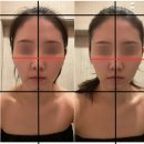 공항대로 41길 | 마곡 피부관리 리프리아 에스테틱 | 윤곽관리 리프팅 효과 솔직후기