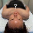 사거리화장품 | [광명 체형관리] 광명 얼굴비대칭관리 잘하는 소담손길 광명사거리점 후기